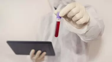 Bronca en Villa Elisa por falta de test de HIV: ¿Se agotaron en un día?